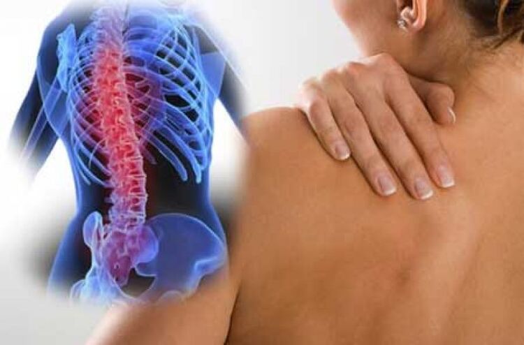 During the exacerbation of osteochondrosis of the thoracic spine, dorsago pain occurs