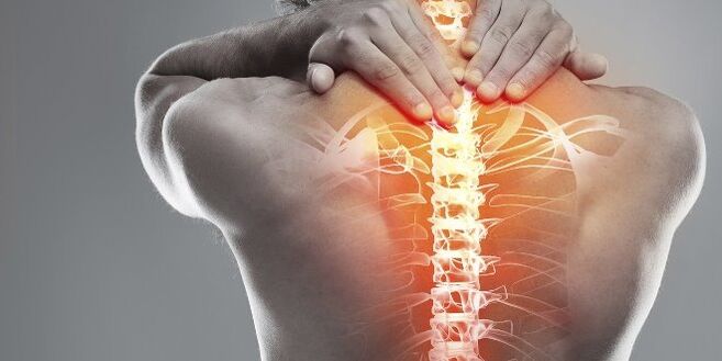 Medical options for cervical therapy cervical osteochondrose