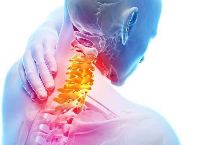 Symptoms and phases of cervical osteochondrose development