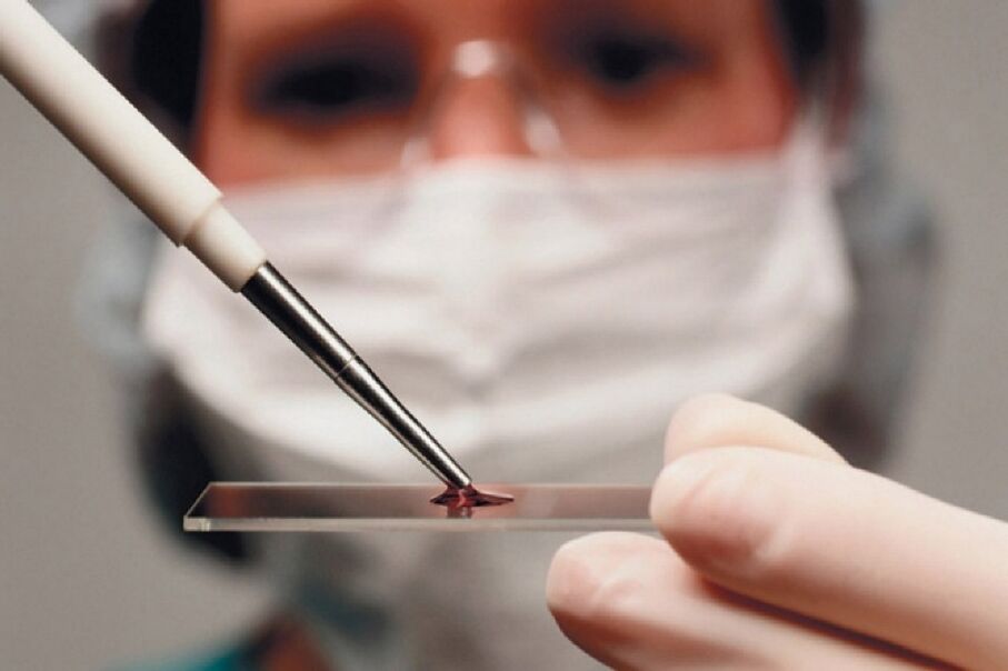 Arthritis is an inflammatory disease, and its presence is detected by a blood test.