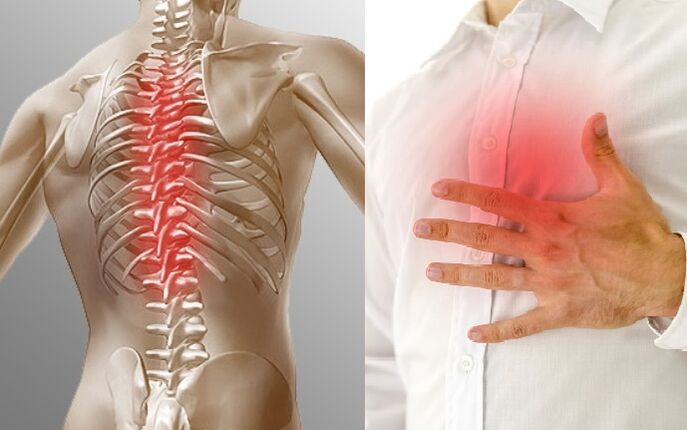 Thoracic osteochondrosis is manifested by pain and tightness in the chest
